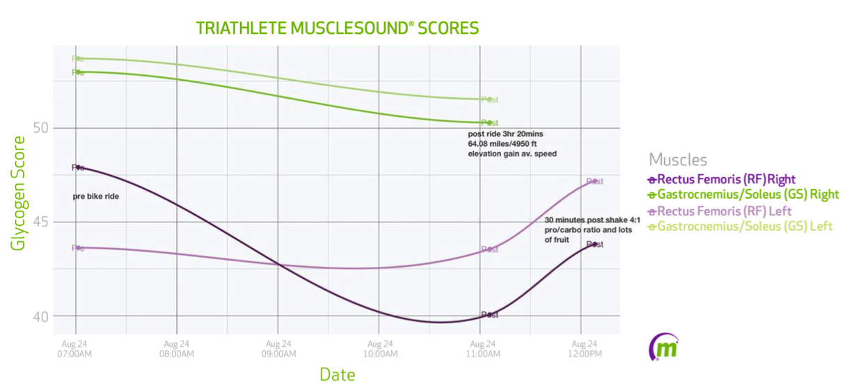 Know Your Athlete | MuscleSound