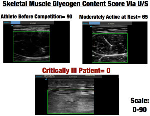 Figure 3 - Skeletal muscle glycogen content score via ultrasound