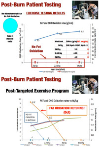 Figure 7 - Exercise Physiology Testing in Burn Patient Prior to Metabolic and Exercise Therapy. B - Exercise Physiology Testing in Burn Patient Following Metabolic and Exercise Therapy. CHO-Carbohydrate. Ox-Oxidation.