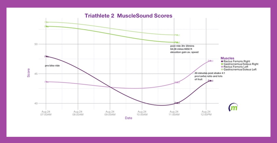 musclesound-score-graph